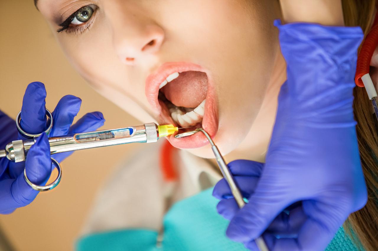 Primjena lokalne anestezije u dentalnoj medicini