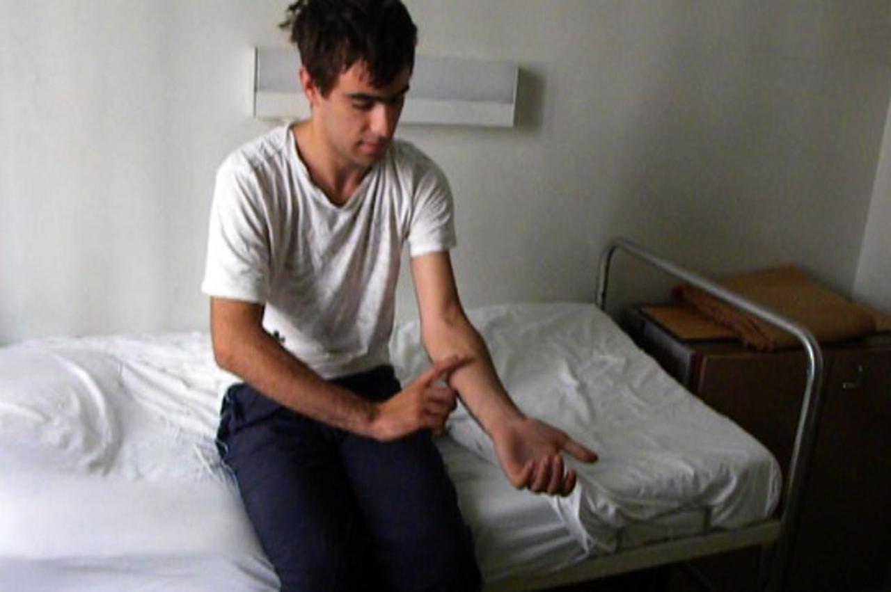 Frane Dević pokazuje ugriz