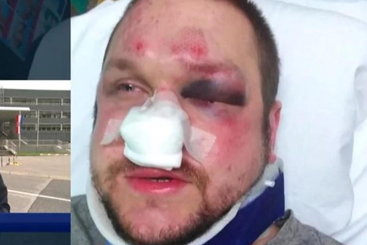 Pretučeni muškarac