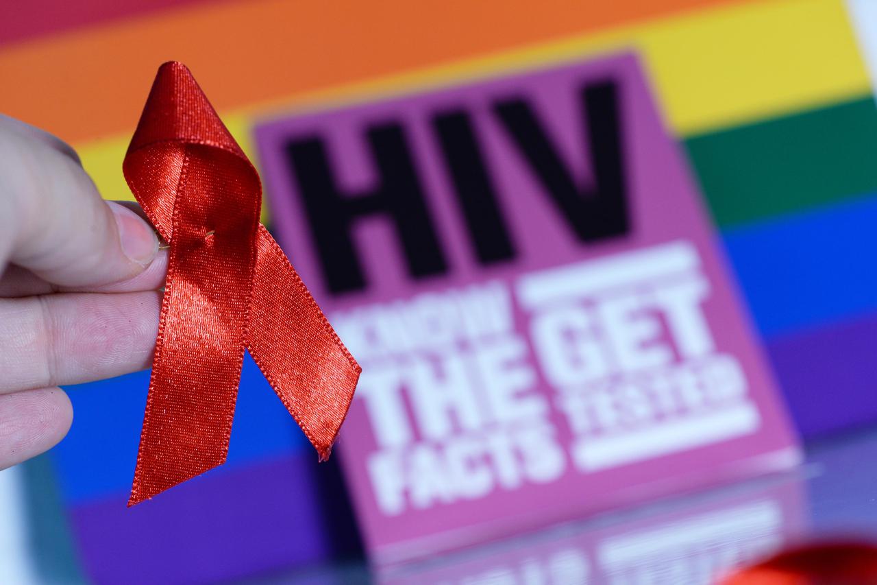 HIV