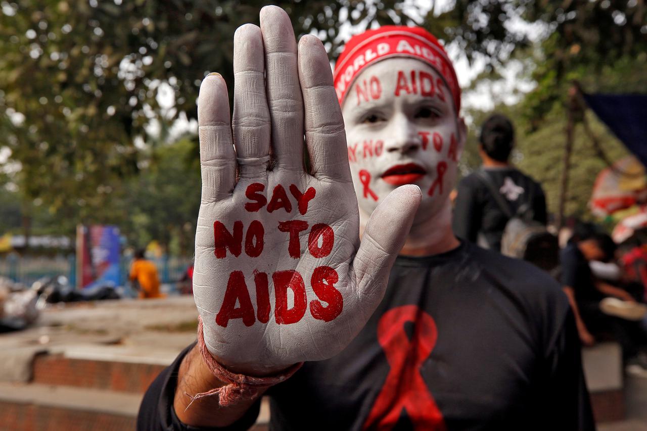 Borba protiv bolesti Brojni aktivisti u svijetu vode svoje oblike borbe protiv AIDS-a, dok se u znanstvenim krugovima u nas posebno ističe Josip Begovac, u RH jedan od sinonima te borbe