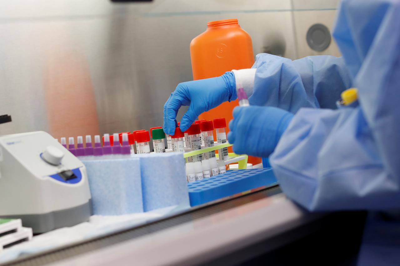 A medical technologist tests a respiratory panel at Northwell Health Labs, where the same test will be used on the COVID-19, the disease caused by the novel coronavirus, in Lake Success, New York