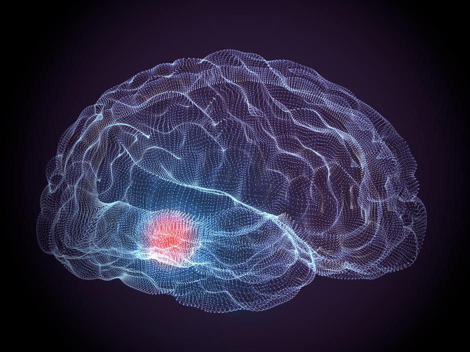 Parkinsonova bolest