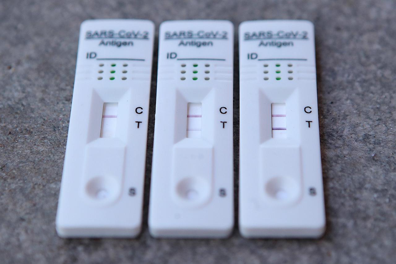 Brzi antigenski test