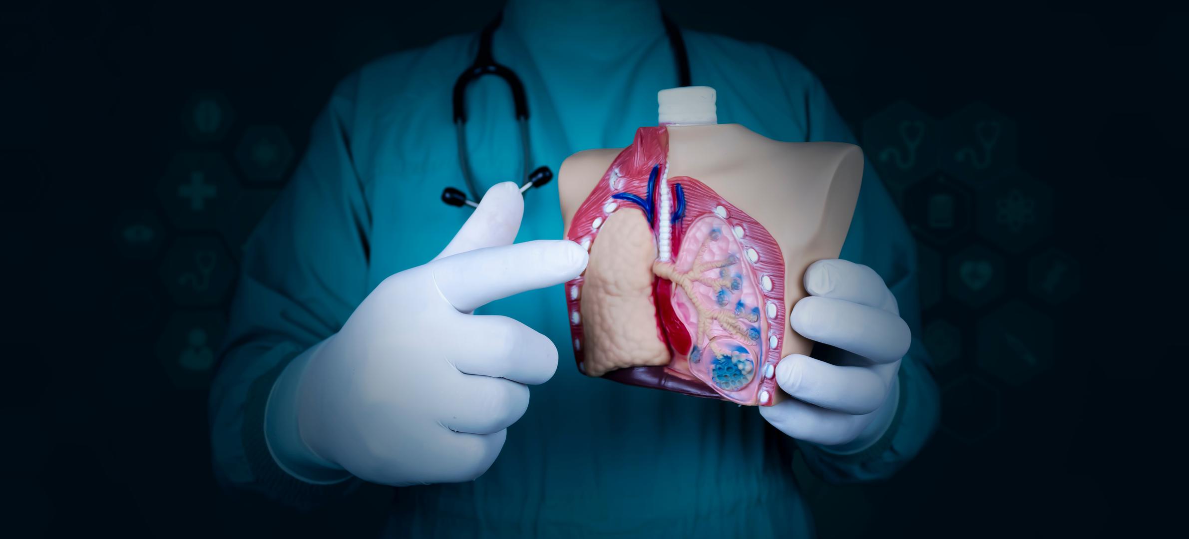 10. Pluća: Gubitak plućnog krila znači da je vaš kapacitet disanja trajno smanjen. Tijelo se prilagođava tako što preostalo plućno krilo radi jače, ali vaše će se fizičke granice promijeniti. "Dok preostalo plućno krilo radi jače i često to izvanredno kompenzira, intenzivna tjelesna aktivnost može postati izazovnija što dovodi do trajne kratkoće daha pri naporu. Atletski ljudi mogu kompenzirati i nastaviti se truditi, ali trebaju biti iznimno oprezni jer male alergije, prehlada ili zagađenje mogu poremetiti ravnotežu", zaključio je liječnik.