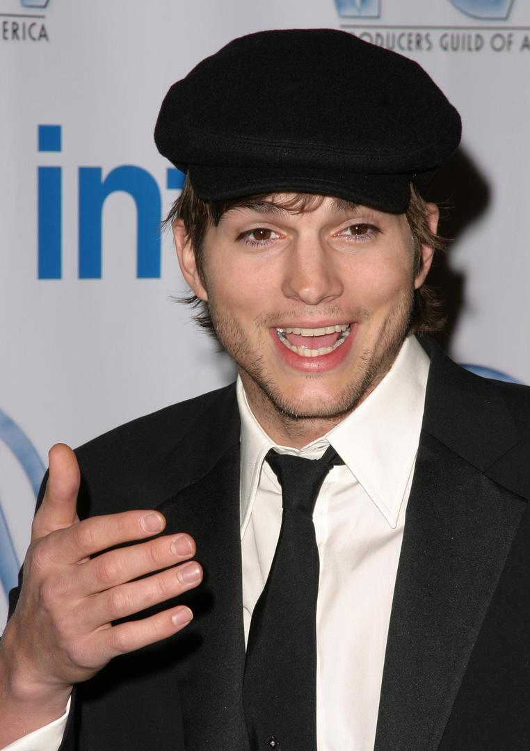 Čim je prestao s uzimanjem lijeka kosa mu je opet počela ispadati i sada stalno nosi kape i šilterice.