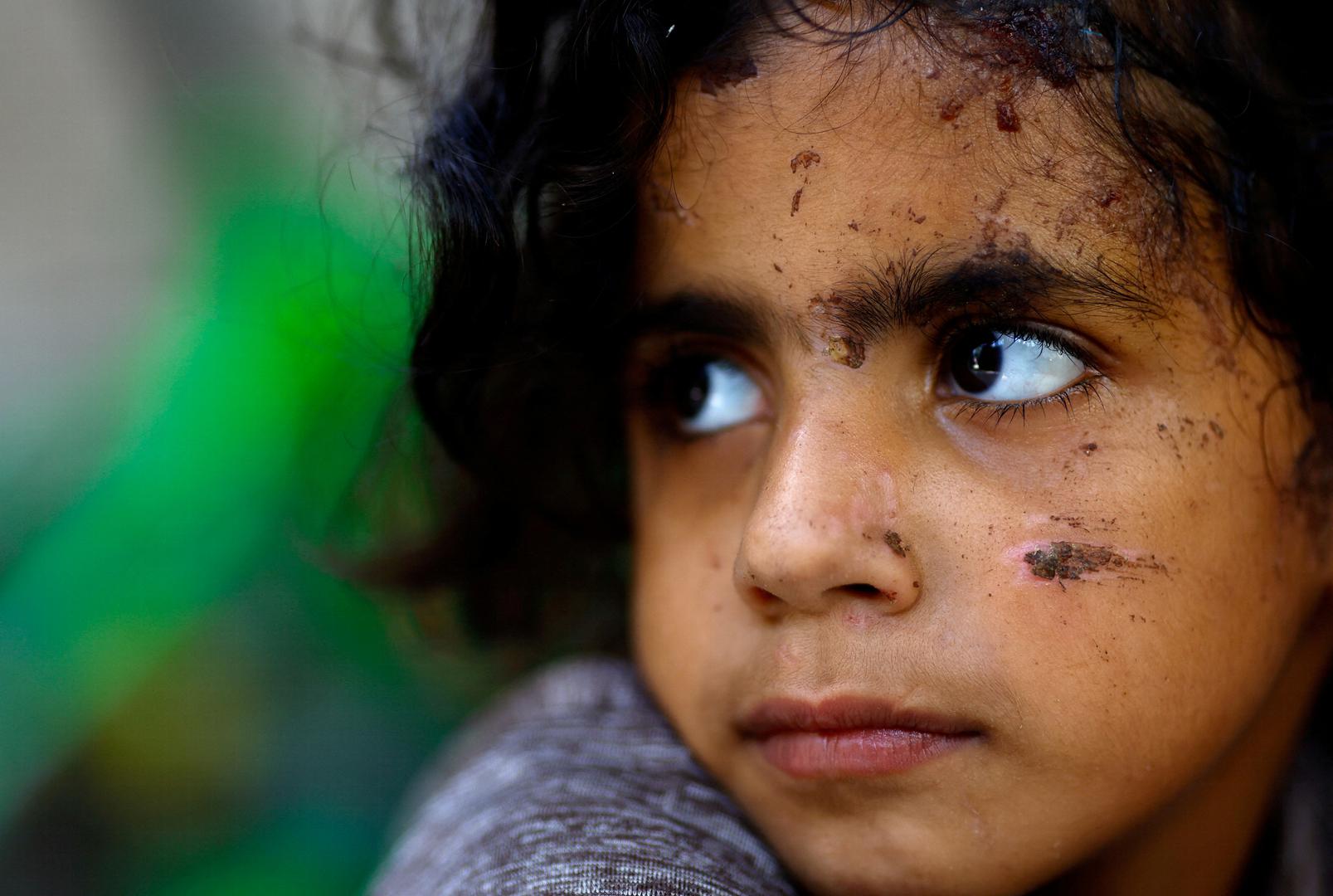 A Palestinian girl, one of the few survivors of Allamdani family, who fled to southern Gaza Strip to avoid the constant onslaught of Israeli airstrikes in Gaza City and settled in a shelter which was later hit by Israeli jets that killed 13 of her relatives, looks on, in Khan Younis in the southern Gaza Strip, October 22, 2023. REUTERS/Mohammed Salem      TPX IMAGES OF THE DAY Photo: MOHAMMED SALEM/REUTERS