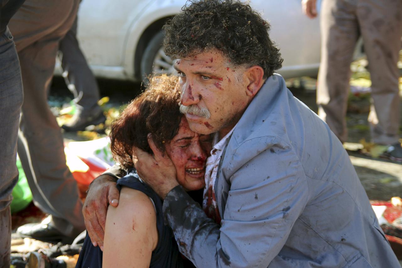 ATTENTION EDITORS - VISUAL COVERAGE OF SCENES OF INJURY OR DEATH An injured man hugs an injured woman after an explosion during a peace march in Ankara, Turkey, October 10, 2015. At least one explosion shook a road junction in the centre of the Turkish ca