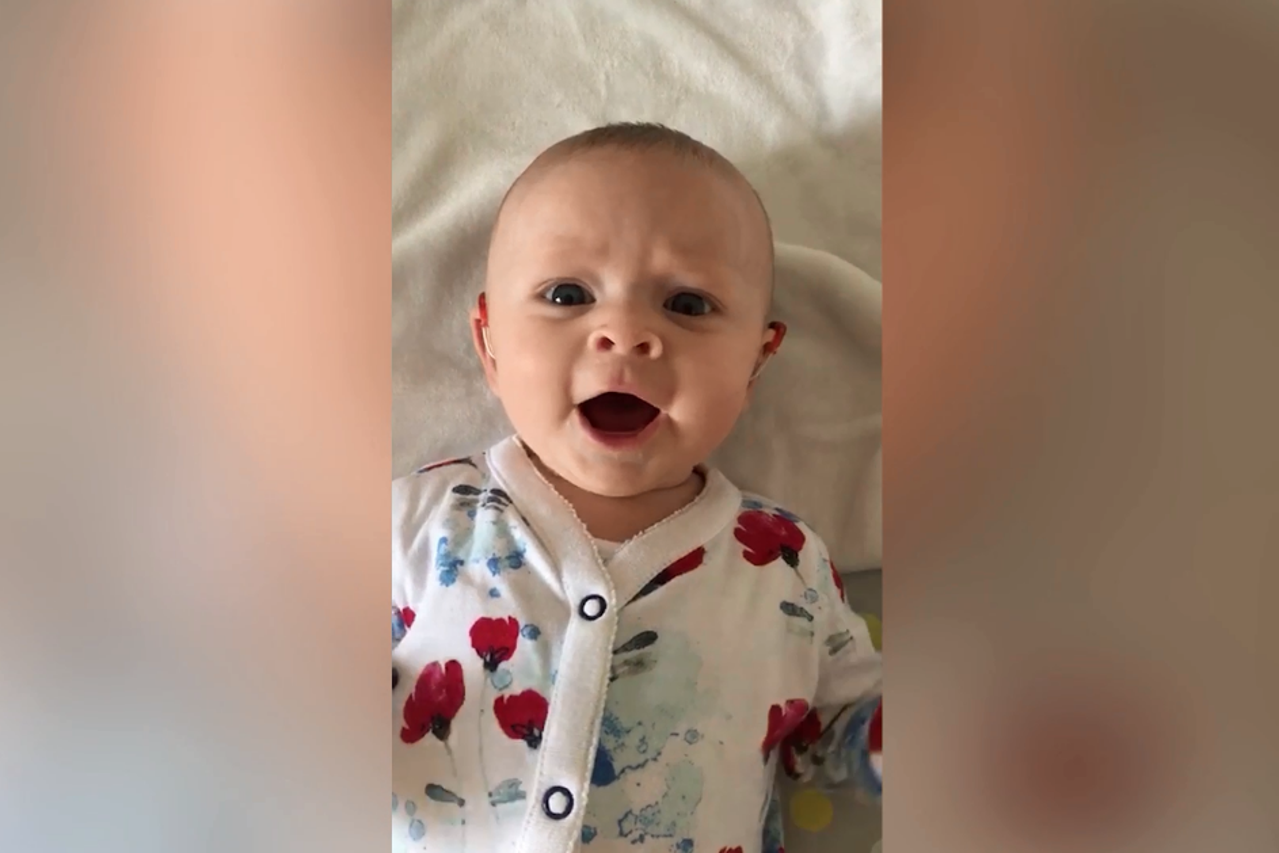 Reakcija gluhe bebe kojoj su stavili aparatić