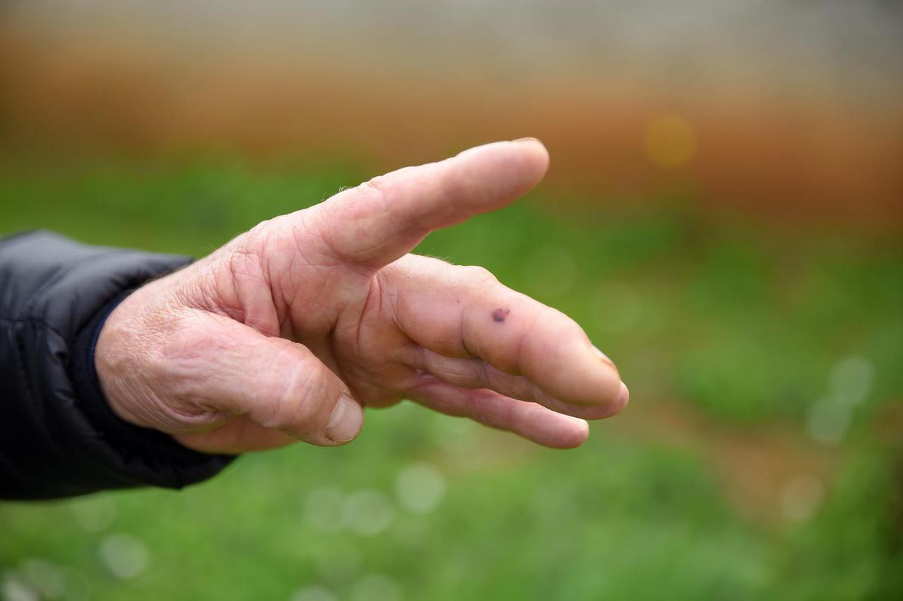 Galižana: Marina ugrizao poskok dok je brao šparoge