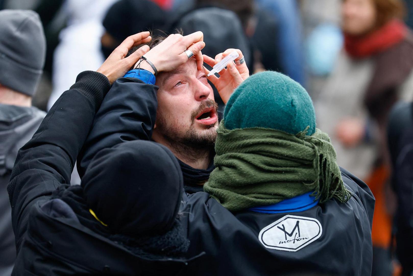A man gets his irritated eye treated at a demonstration by workers and trade union members, as part of a national strike demanding stronger public services in Brussels, Belgium February 13, 2025. REUTERS/Stephanie Lecocq Photo: STEPHANIE LECOCQ/REUTERS