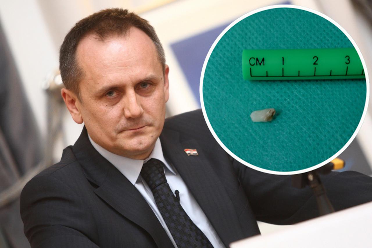 drago prgomet i zubić