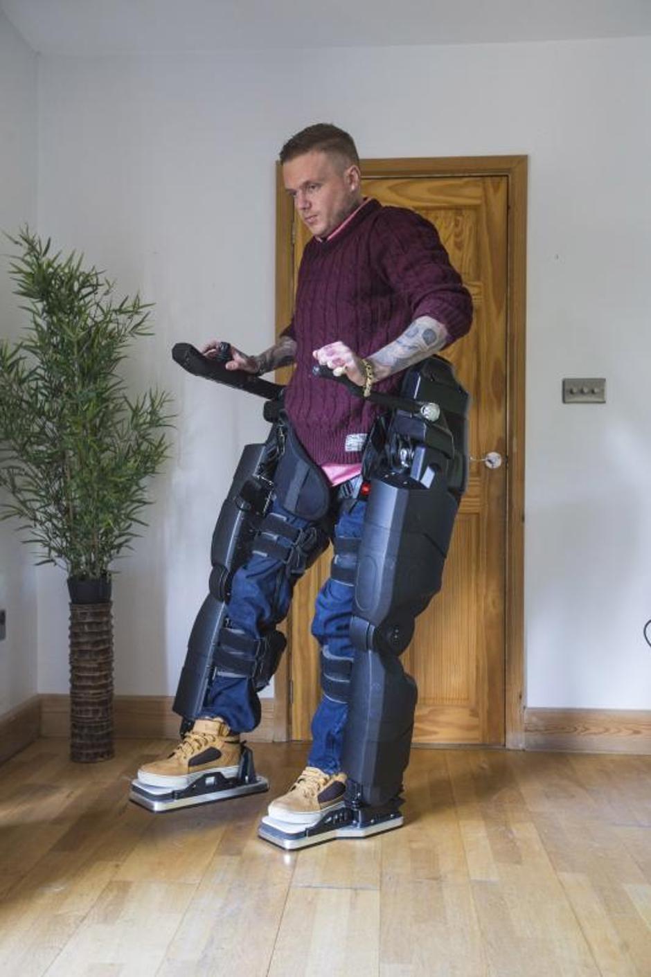 Ben Barnes, bioničke noge