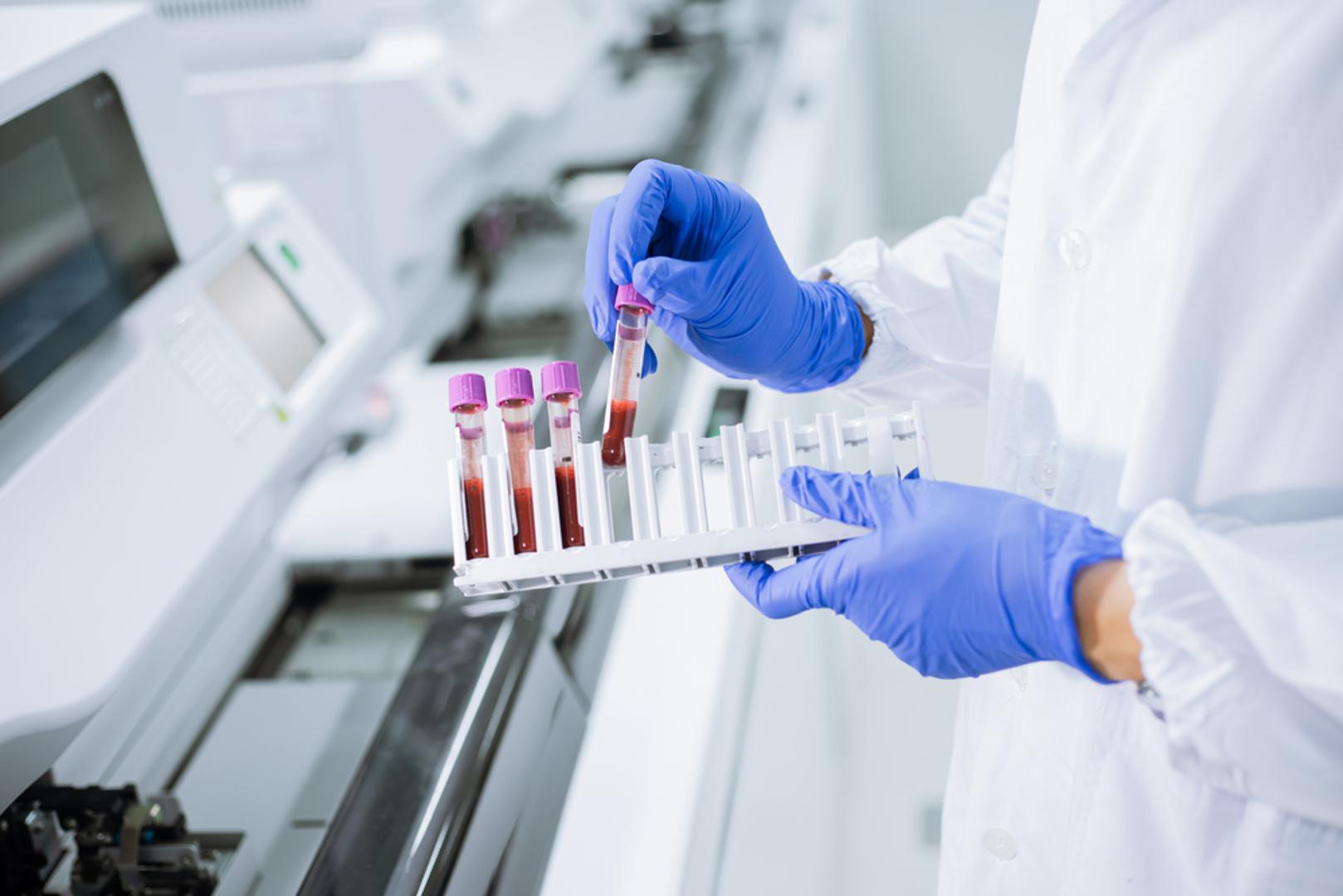 Važno je znati i da blaži oblici ponekad gotovo uopće nemaju jasne simptome, dok se kod izraženijeg manjka tegobe pojačavaju. Zato signale koje tijelo šalje ne treba ignorirati, nego ih shvatiti kao upozorenje da je vrijeme za pregled i laboratorijske nalaze. 