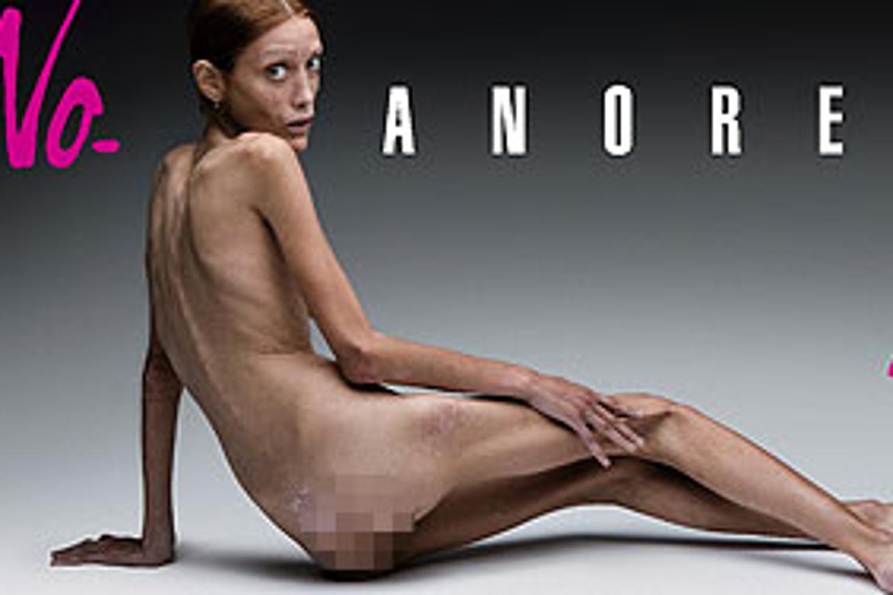 Plakat za kampanju: Kampanja Oliviera Toscanija, poznatog fotografa za borbu protiv anoreksije