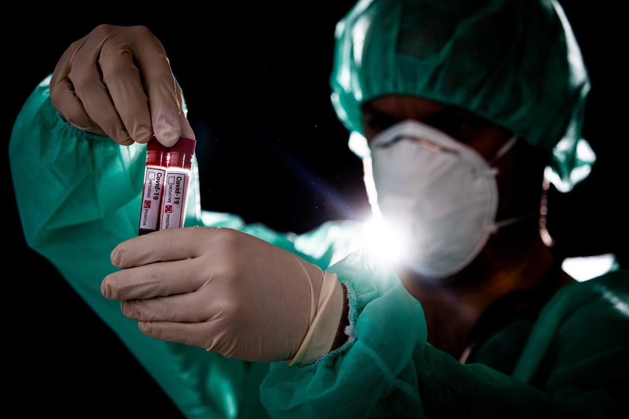 Epruvete s uzorcima krvi - testiranje na koronavirus