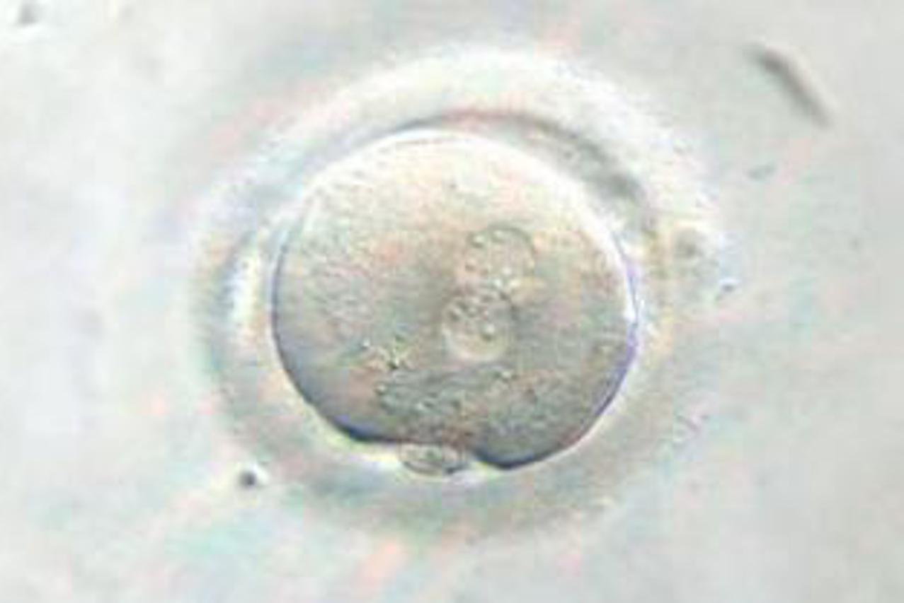 embrij
