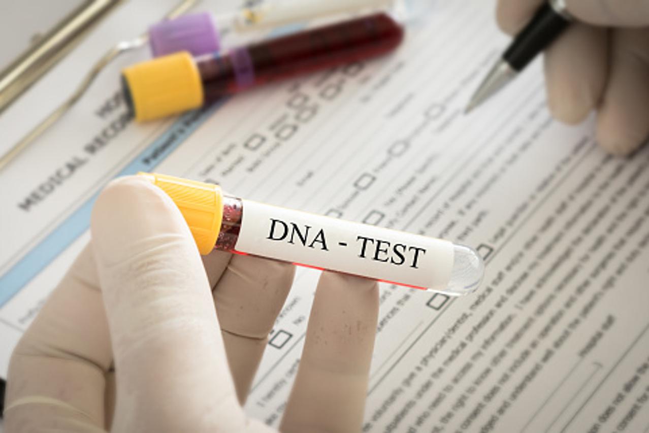 DNK testiranje