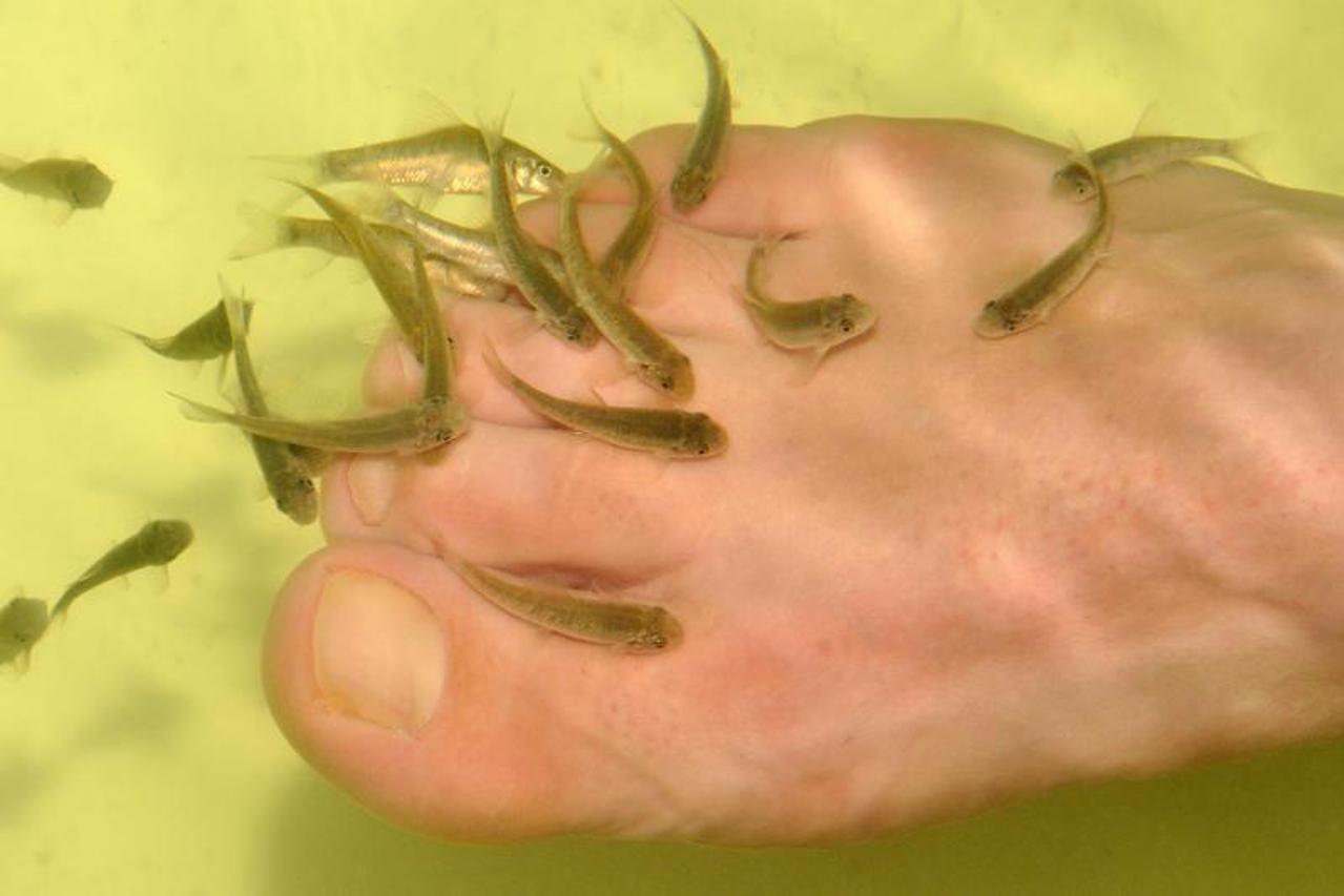 Ribice liječe psorijazu, portal