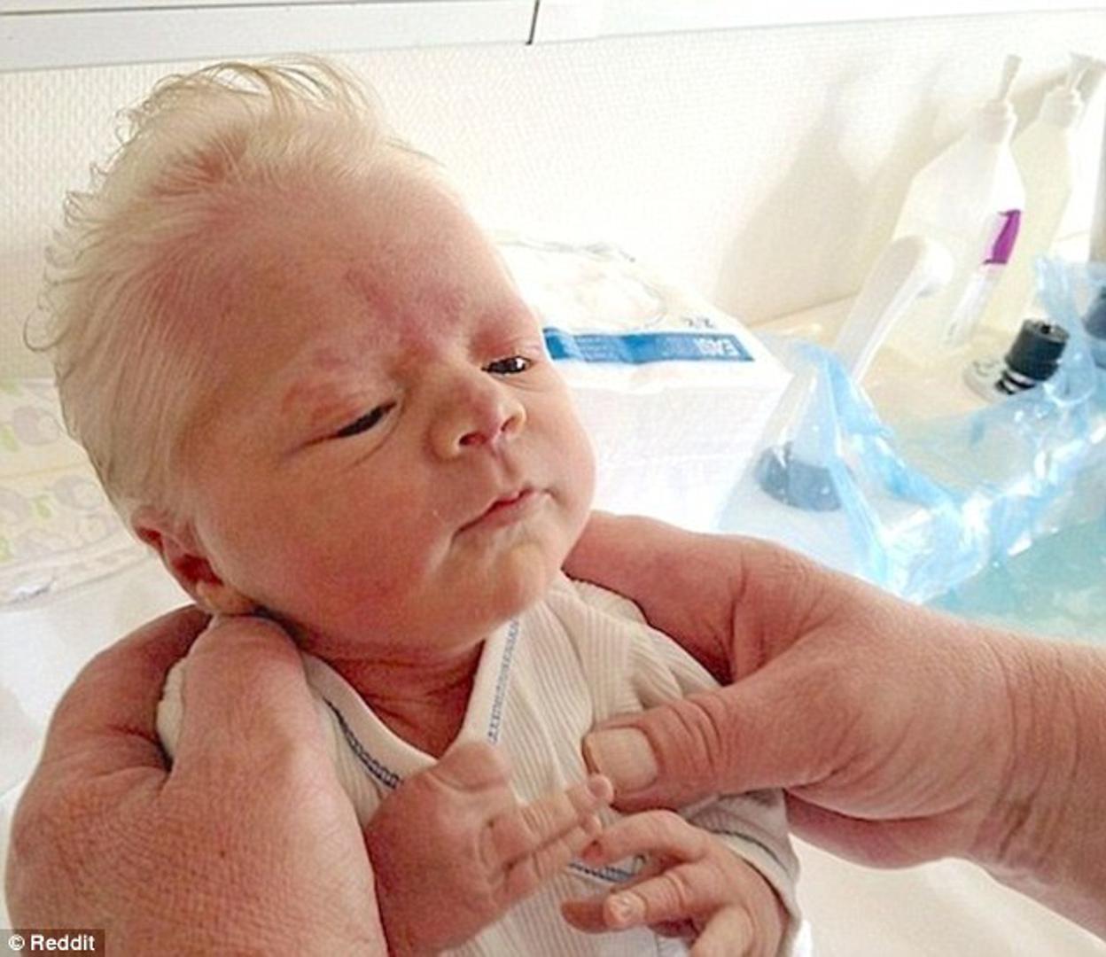Beba Bence rođen je u Mađarskoj, a ono što je šokiralo jest činjenica da je rođen s jako mnogo kose, ali i to da je njegova kosa potpuno bijela. Iako su već zabilježeni slični slučajevi, doktori nisu jedinstveni u stavu u koju kategoriju ovaj slučaj svrstati.