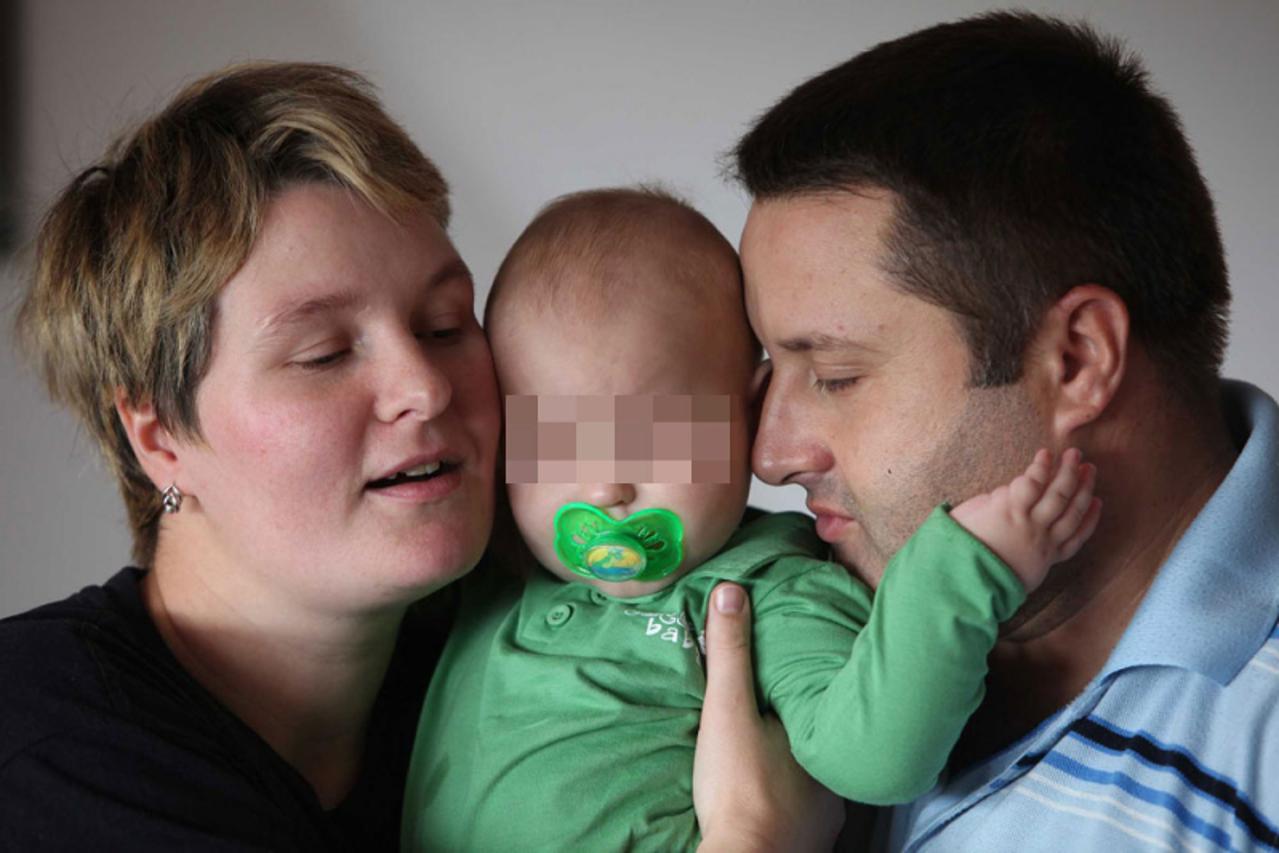 beba bez očnih jabučica