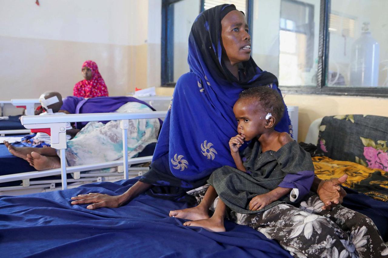 Hajira Ali, a Somali woman displaced by the worsening drought due to failed rain seasons, holds her malnourished child Farhia Hassan, 2, at the paediatric ward in the Banadir Hospital of Mogadishu