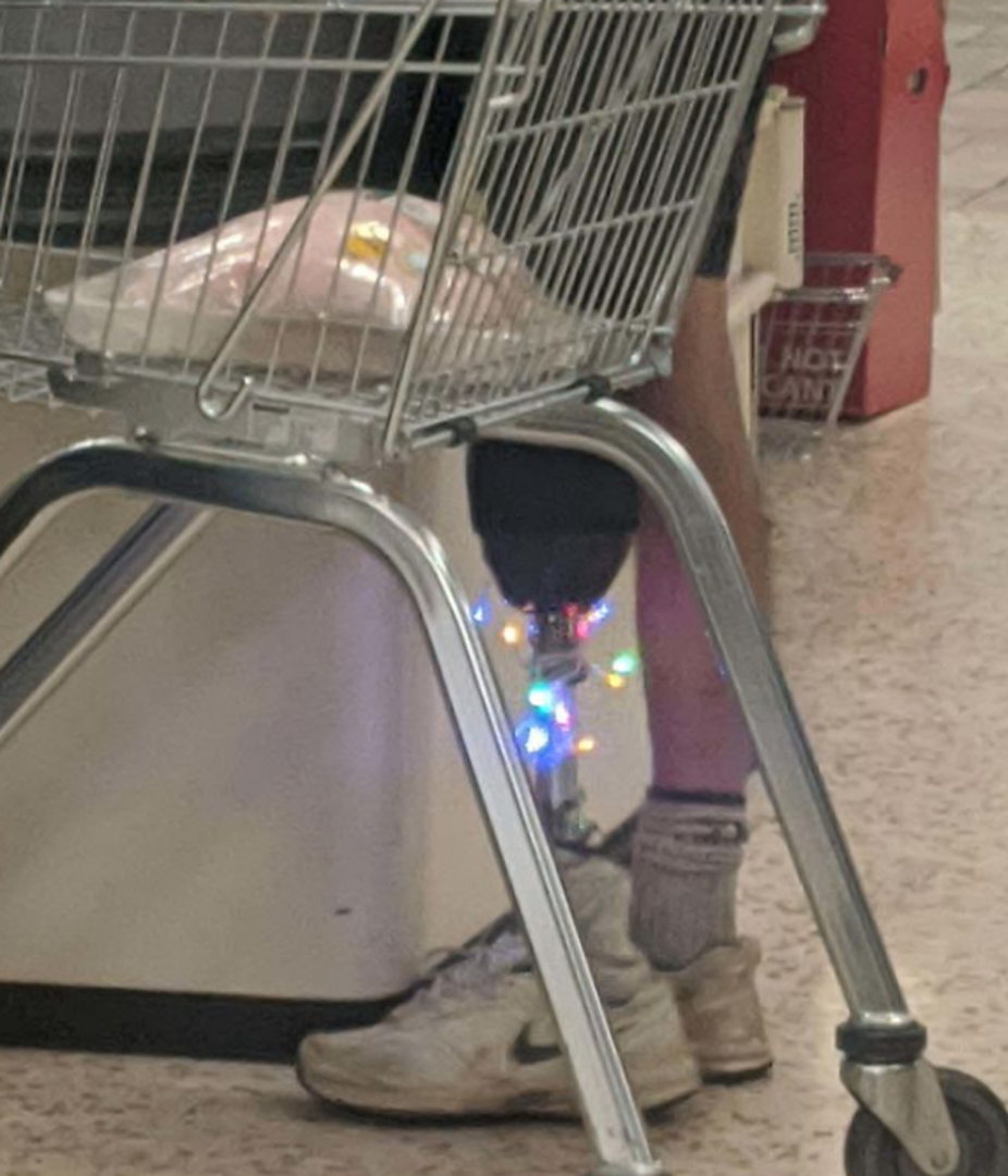 Jedan muškarac odlučio je sebe ukrasitit u duhu božićnih praznika, pa si je tako na umjetnu nogu stavio lampice.