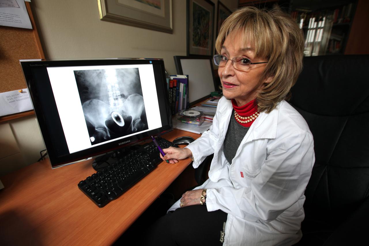 26.01.2010., Zagreb, Hrvatska - KBC Rebro Zagreb, zavod za Radiologiju, predstojnica zavoda za radiologiju, Prof.dr.sc Ranka Stern-Padovan. 