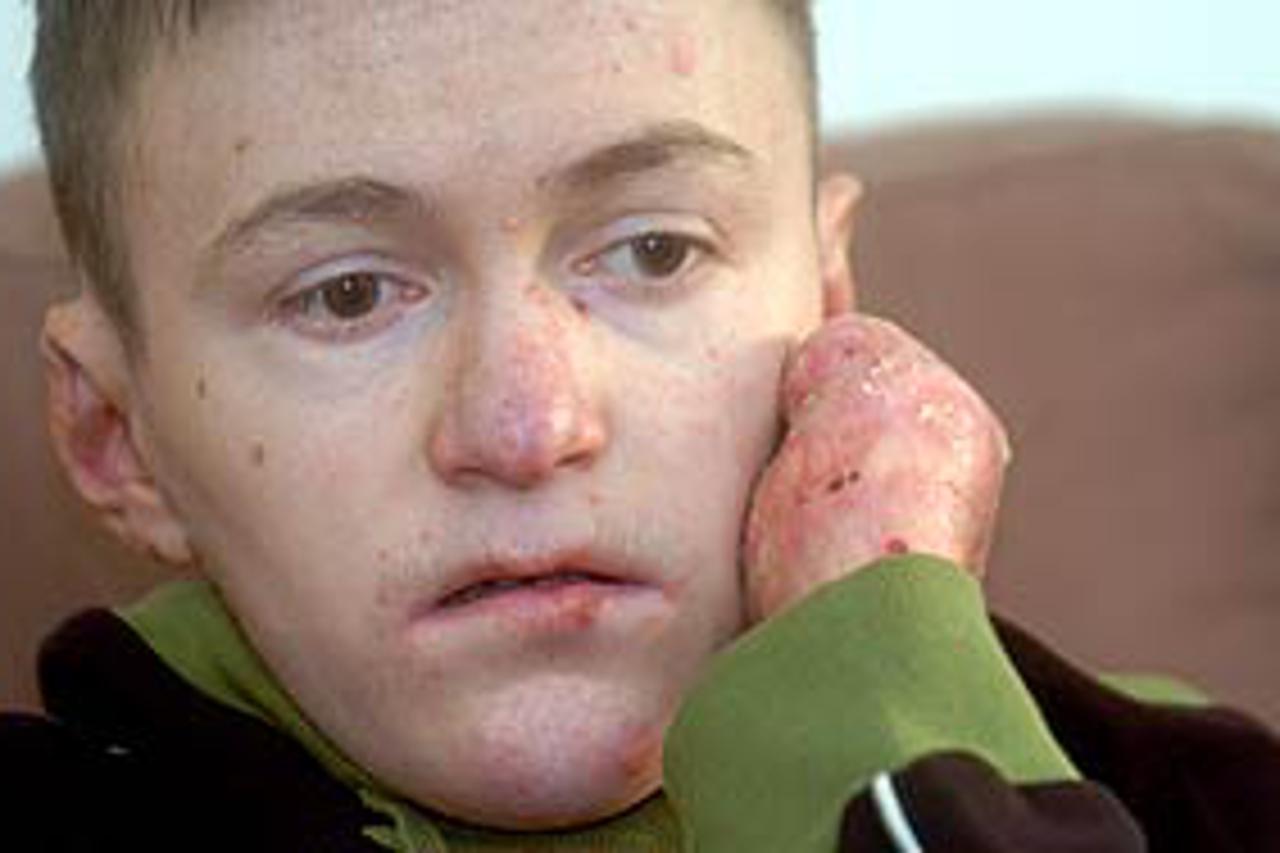 U Centru za odgoj i obrazovanje djece s invaliditetom sam se preporodio, završio školu, tu sam stekao prijatelje, mogao normalno razgovarati