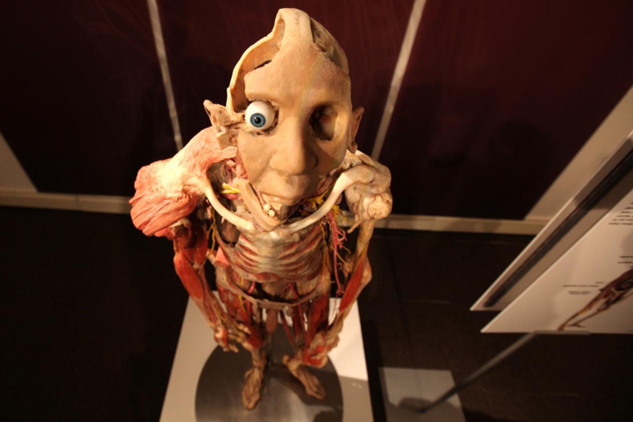 '07.04.2010., Zagreb - Galerija Klovicevi dvori, glasovita edukativna svjetska izlozba Bodies Revealed stigla je u Zagreb.Svecano otvorenje izlozbe je 09.travnja 2010.  Photo: Robert Anic/PIXSELL'