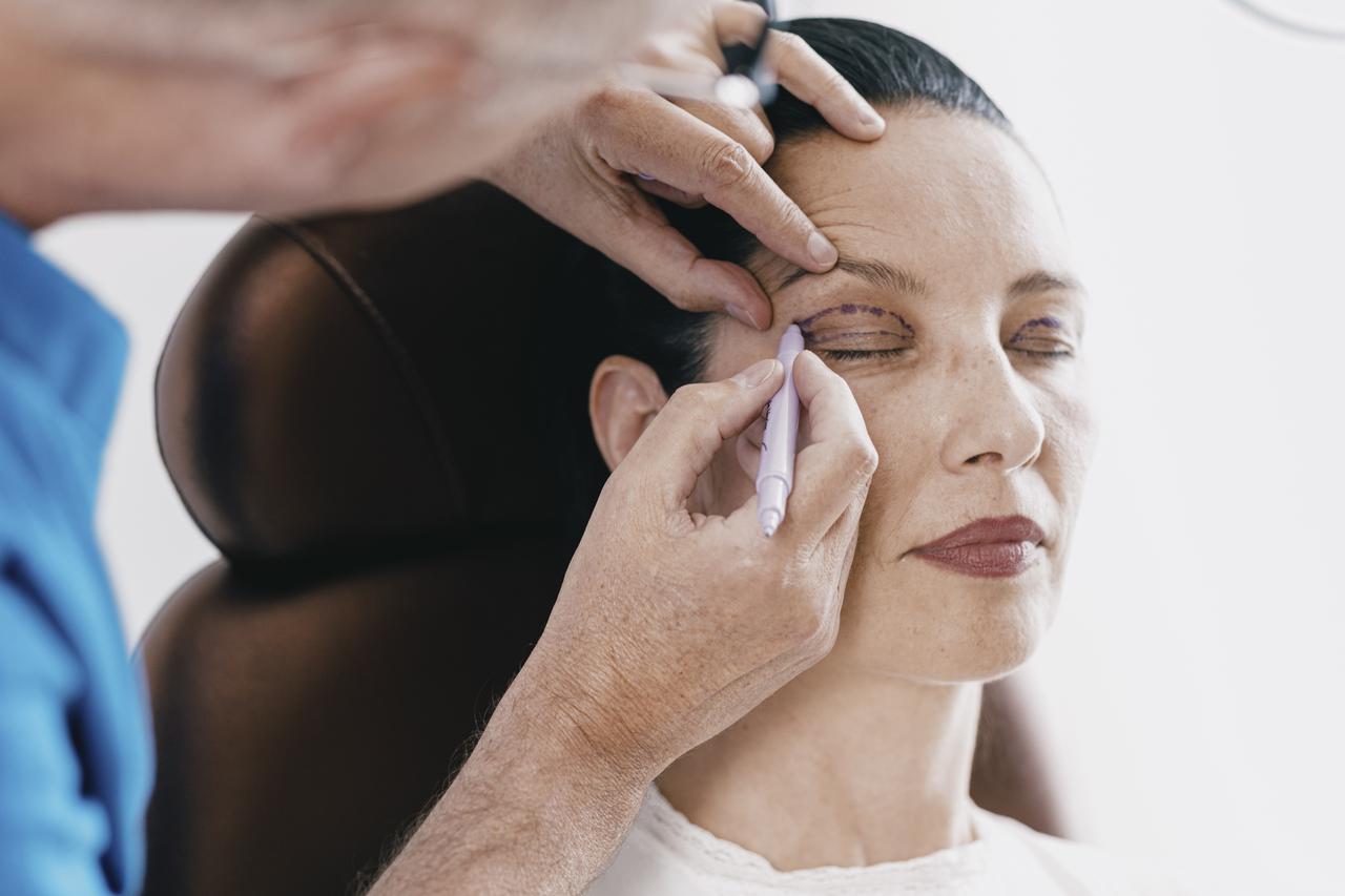 Blefaroplastika – korekcija kapaka