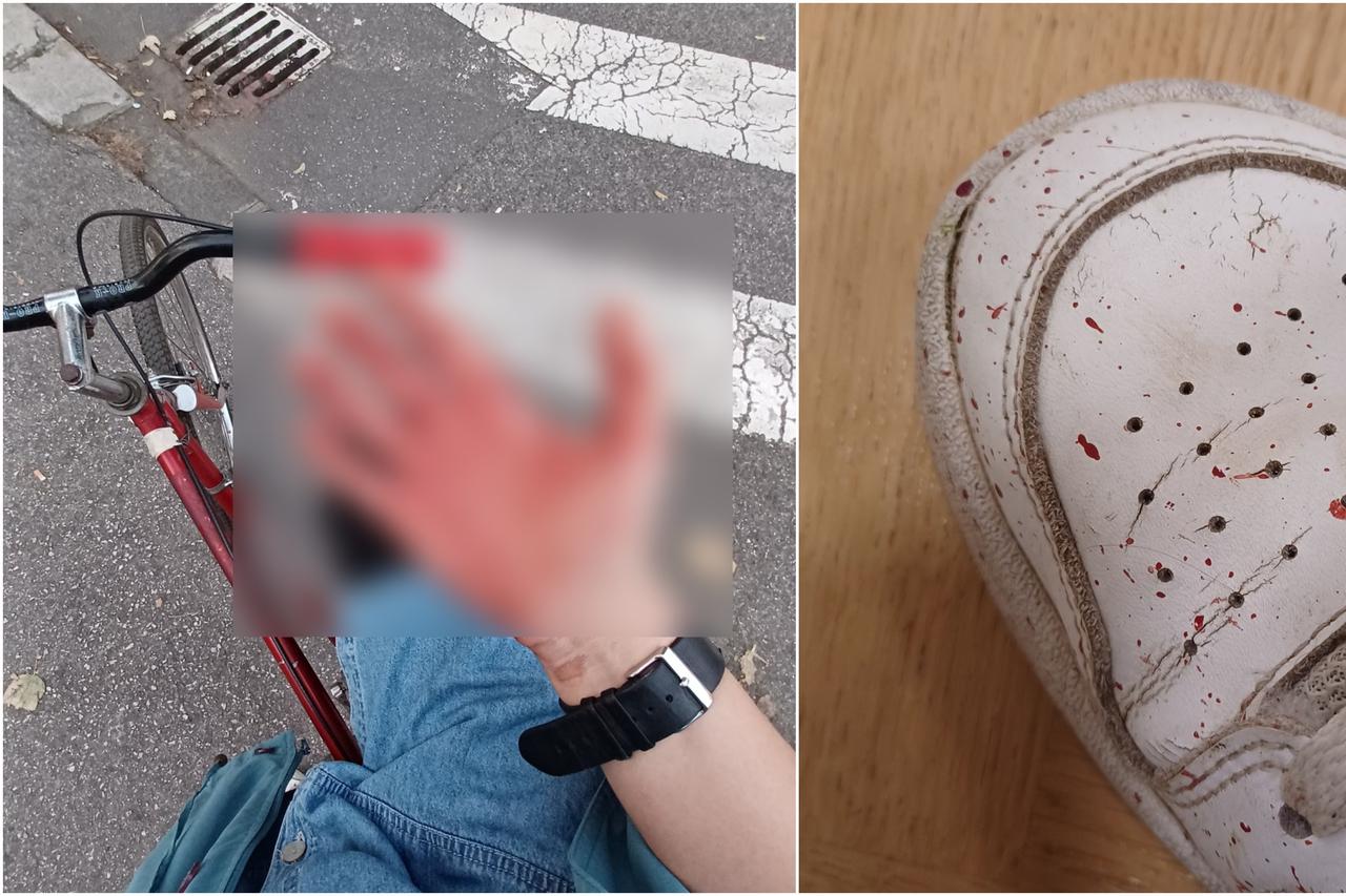 Mladiću cigla pala na glavu