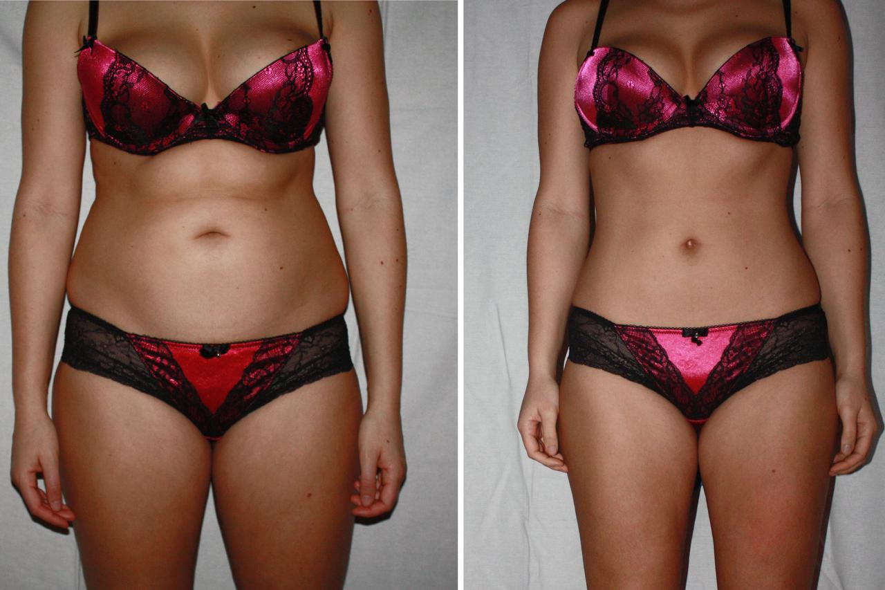 Revolucionarna metoda mršavljenja