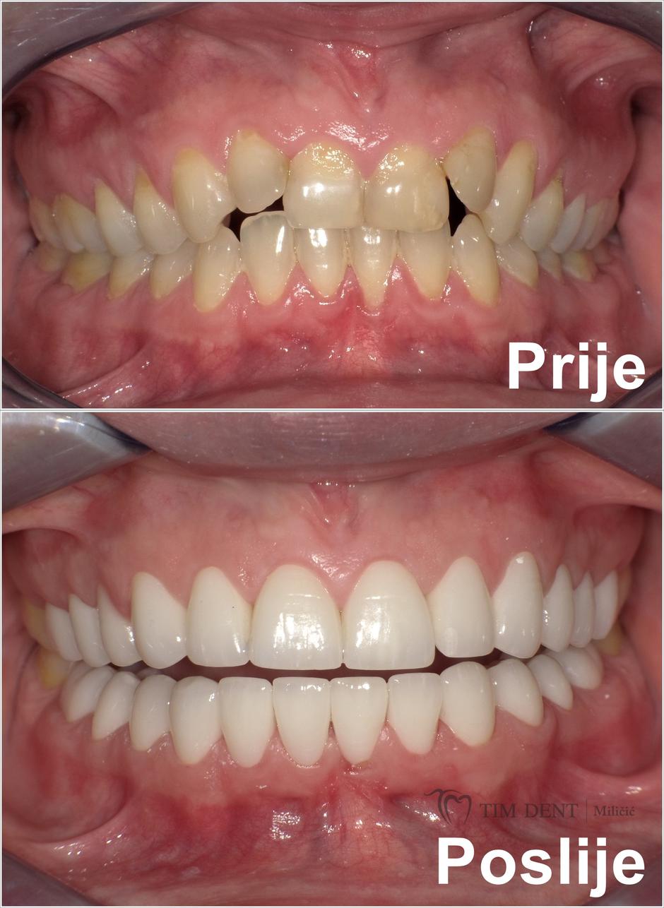 TIM DENT Miličić