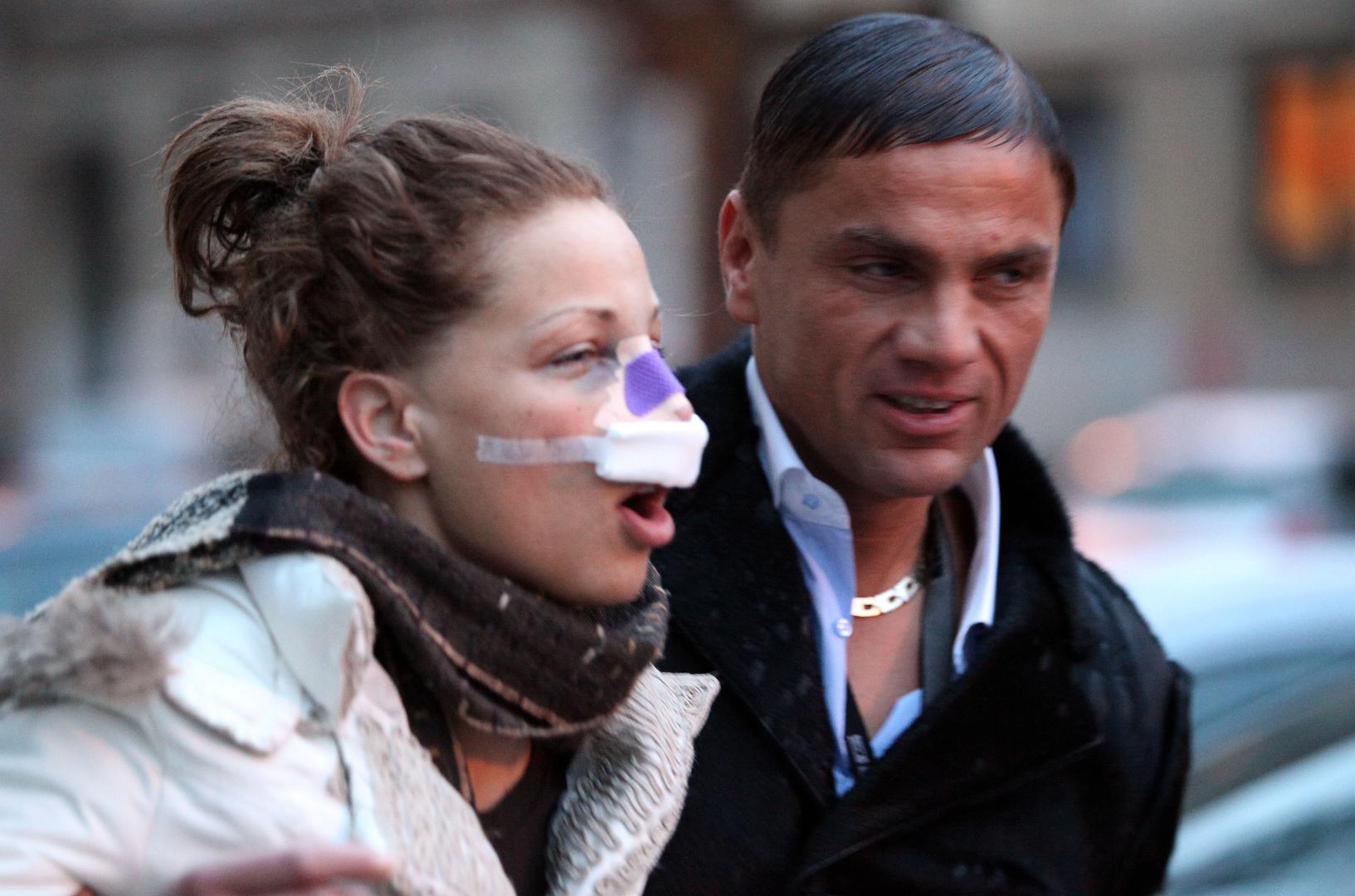 Nakon kratkih zaruka uselili su zajedno u Lanin stan na zagrebačkom Srebrenjaku. Ante joj je poklonio stan, automobil Golf V GTI i Mercedes SL te financirao operaciju nosa. Međutim, veza nije dugo potrajala. Već nakon nekoliko tjedana zajedničkog života počele su svađe i međusobne optužbe. Gotovac je tvrdio da je Lana „neodgovorna i sklona noćnim izlascima“, a mediji su zabilježili i njihove verbalne sukobe te njegov odlazak iz zajedničkog doma.