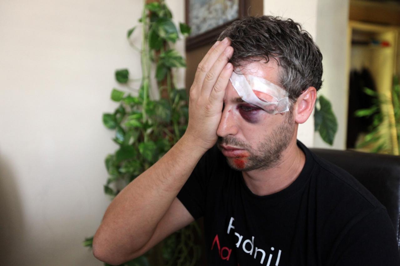 \'12.07.2011., Zadar - Jure Gulan sa svoje dvije kceri i trudnom zenom isao je na kupanje, no na putu prema Biogradu cetvero pripadnika Romske manjine pretuklo je palicama Juru pred njegovom obitelji.
