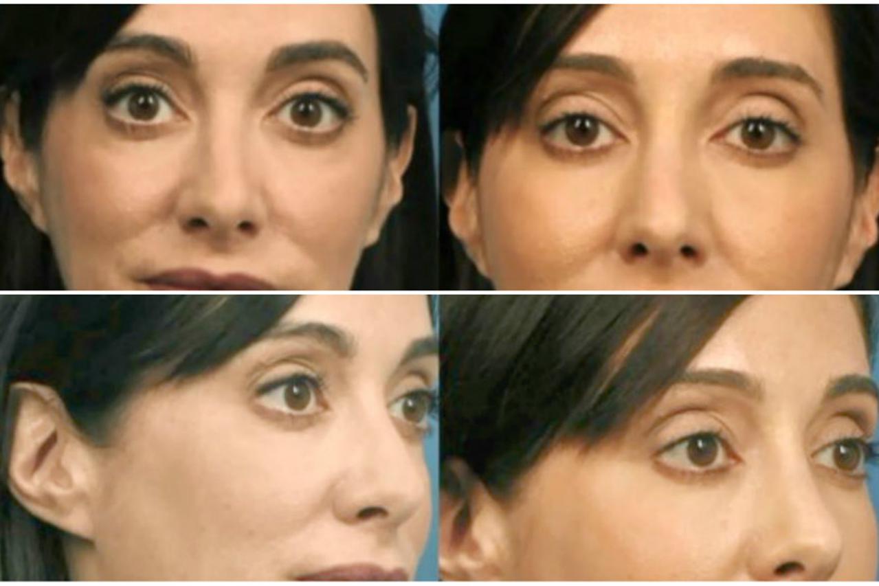 Operirala se zbog selfieja