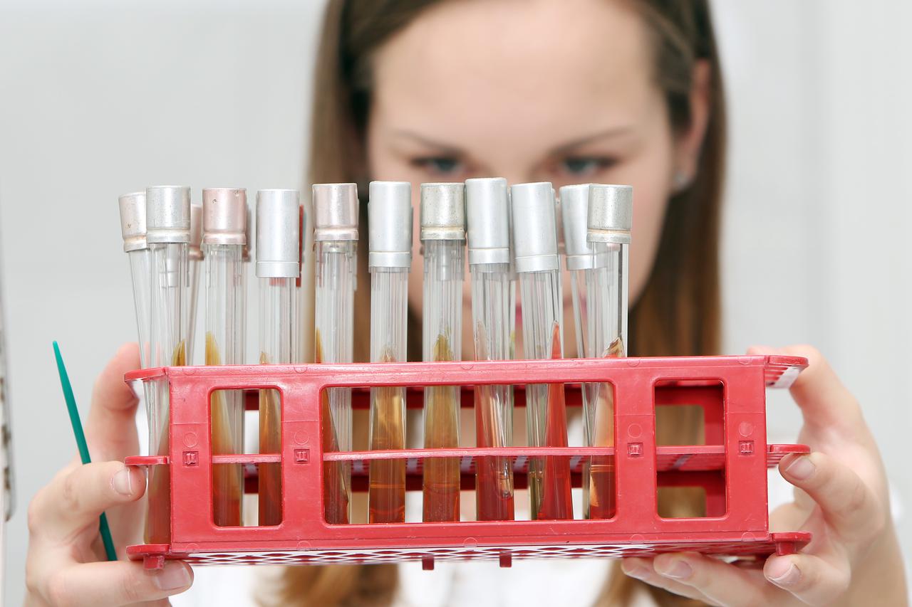 Karlovac: Dan otvorenih vrata biokemijskog laboratorija