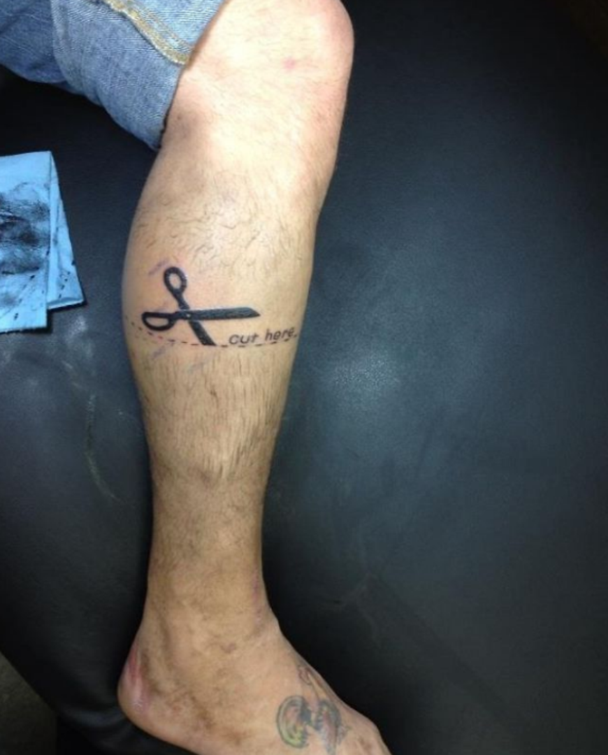 Muškarac je mjesec dana prije amputacije tetovirao škare i oznaku "Prerezati ovdje" na dijelu gdje će ostati bez noge.