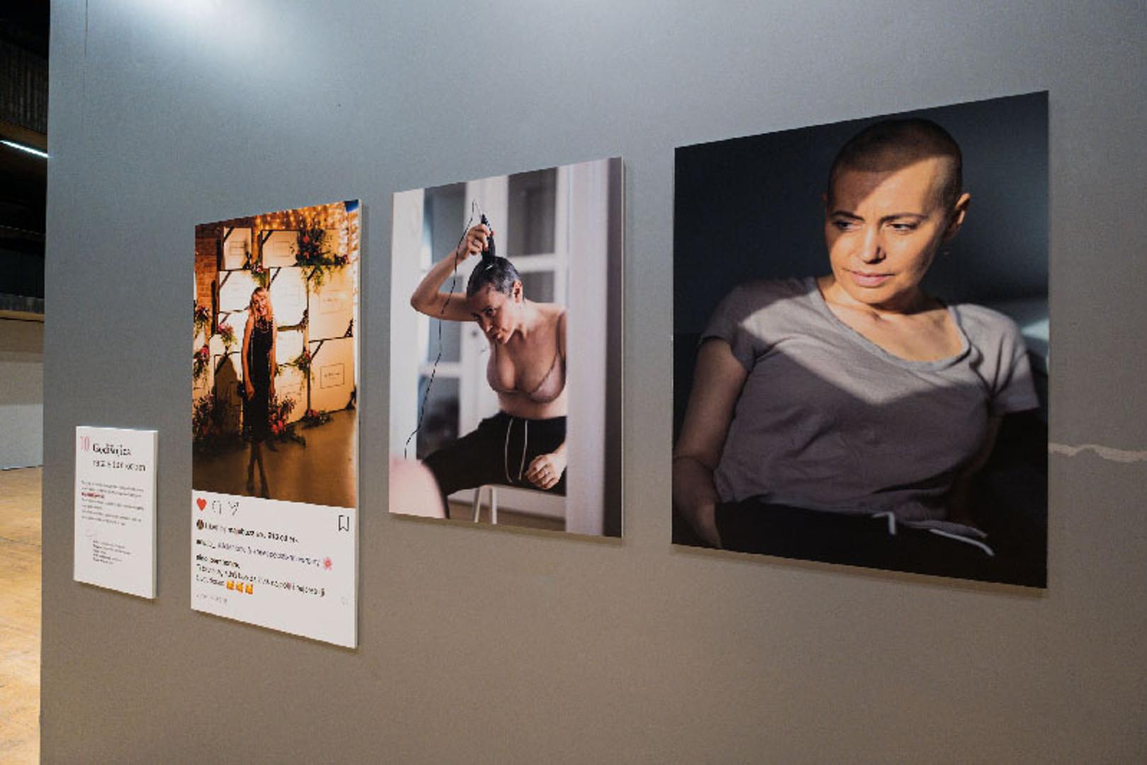 Ana Josipović prikazala je kako izgleda gubitak kose i grudi te kako se s takvim stanjem nositi u današnje vrijeme opsjednuto estetikom tijela.