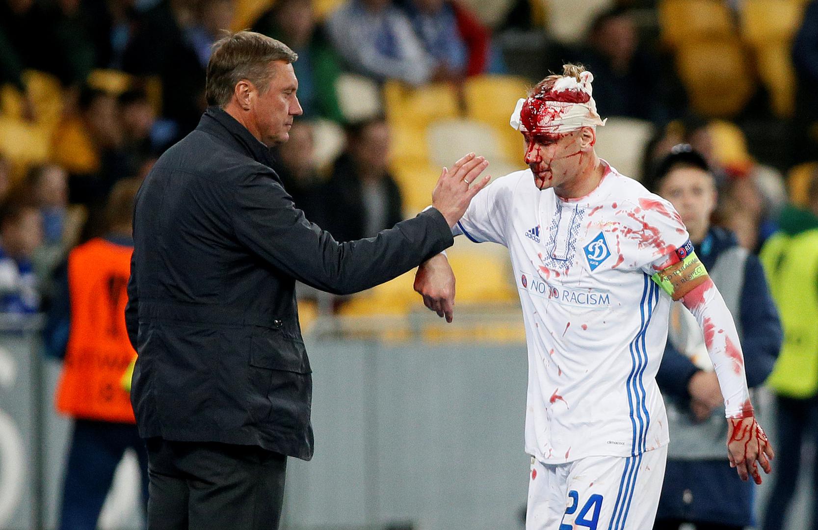 Domagoj Vida utakmicu trećeg kola Europske lige između njegova Dinamo Kijeva i Young Boysa (2:2) završio je rasječene glave i obliven krvlju.