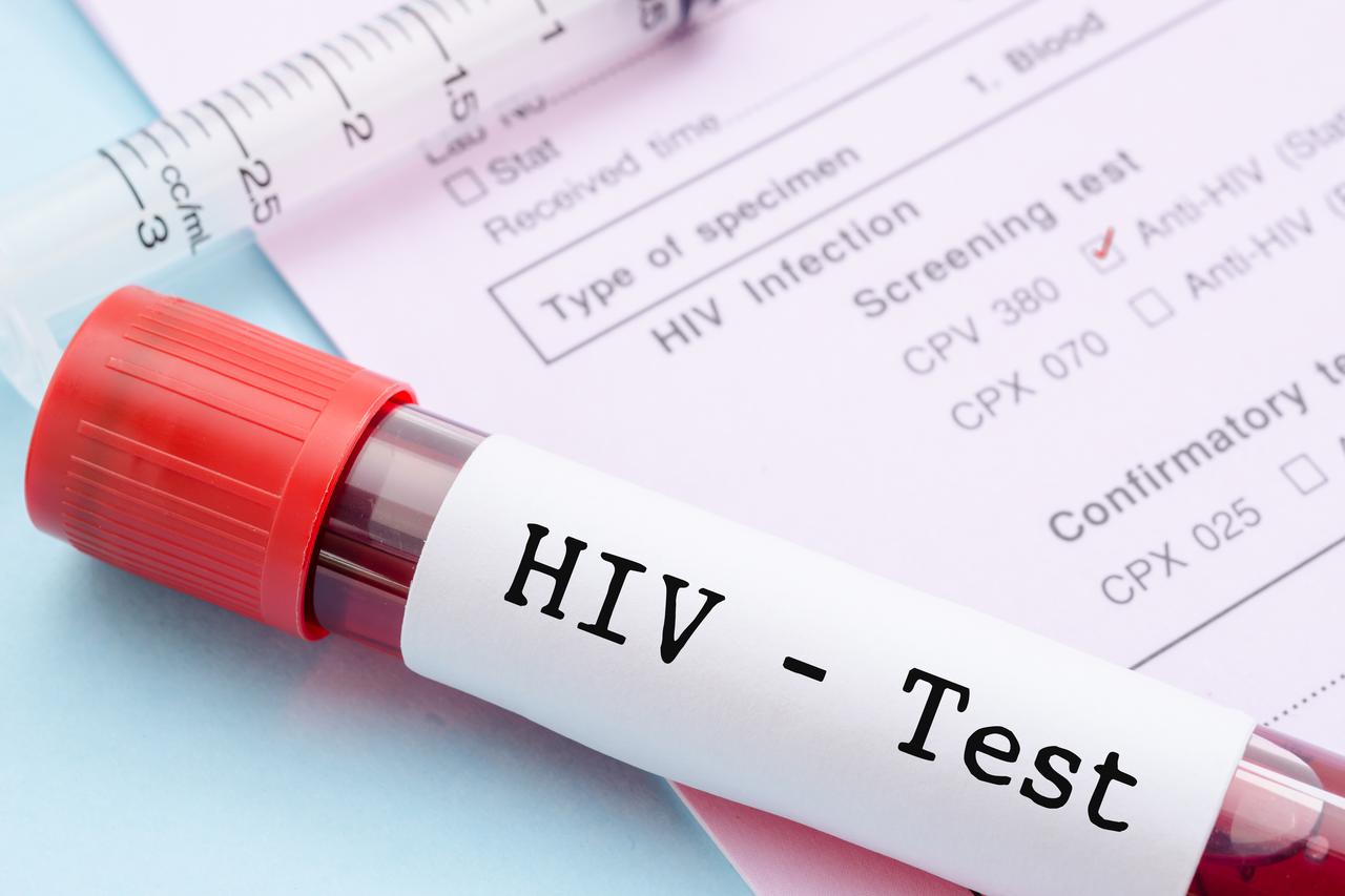 HIV