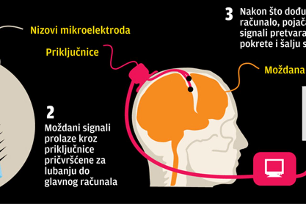 robotska ruka