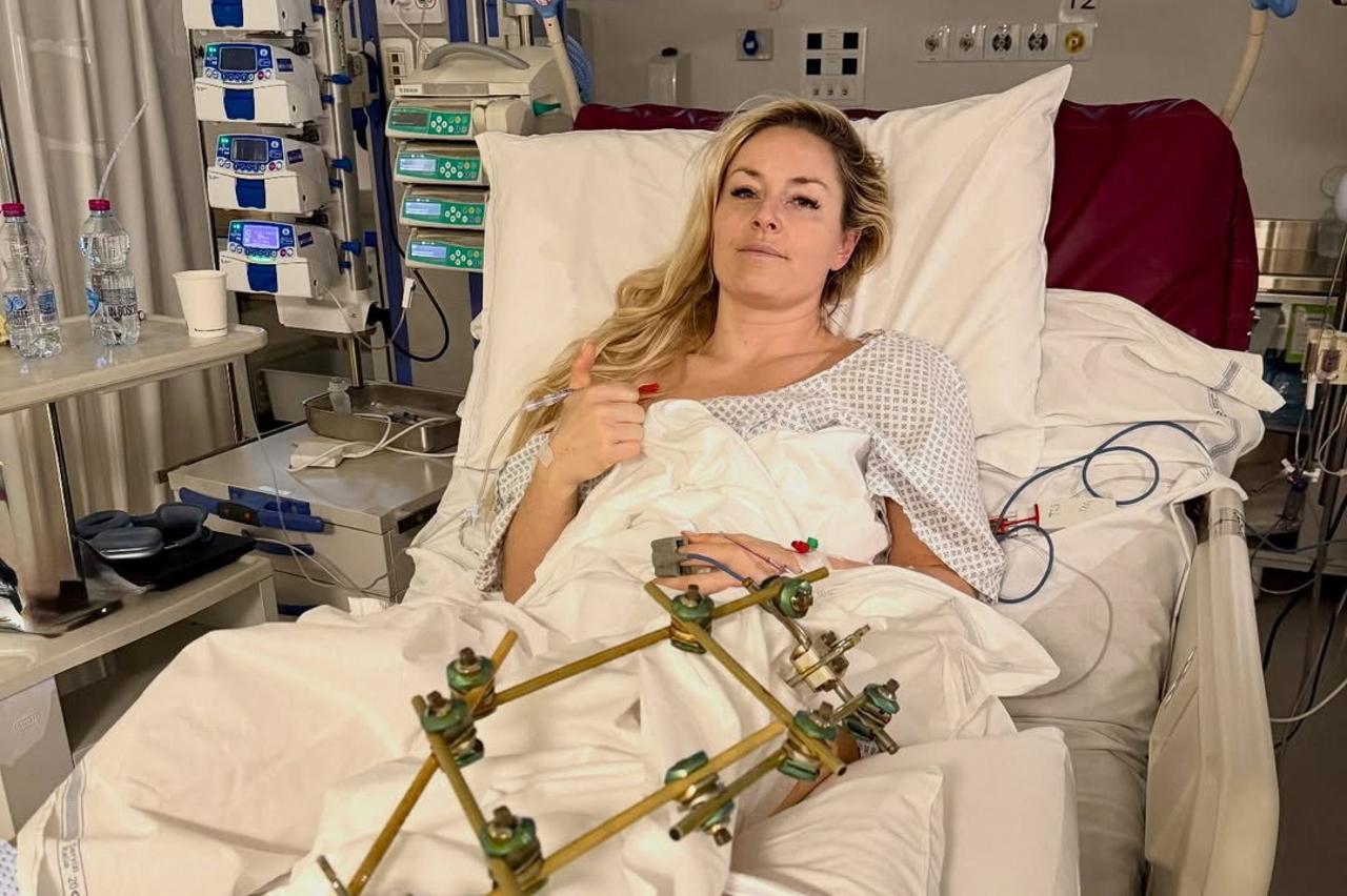 U.S. skier Lindsey Vonn lies in a hospital bed, after she crashed during the Women's Downhill, in Treviso