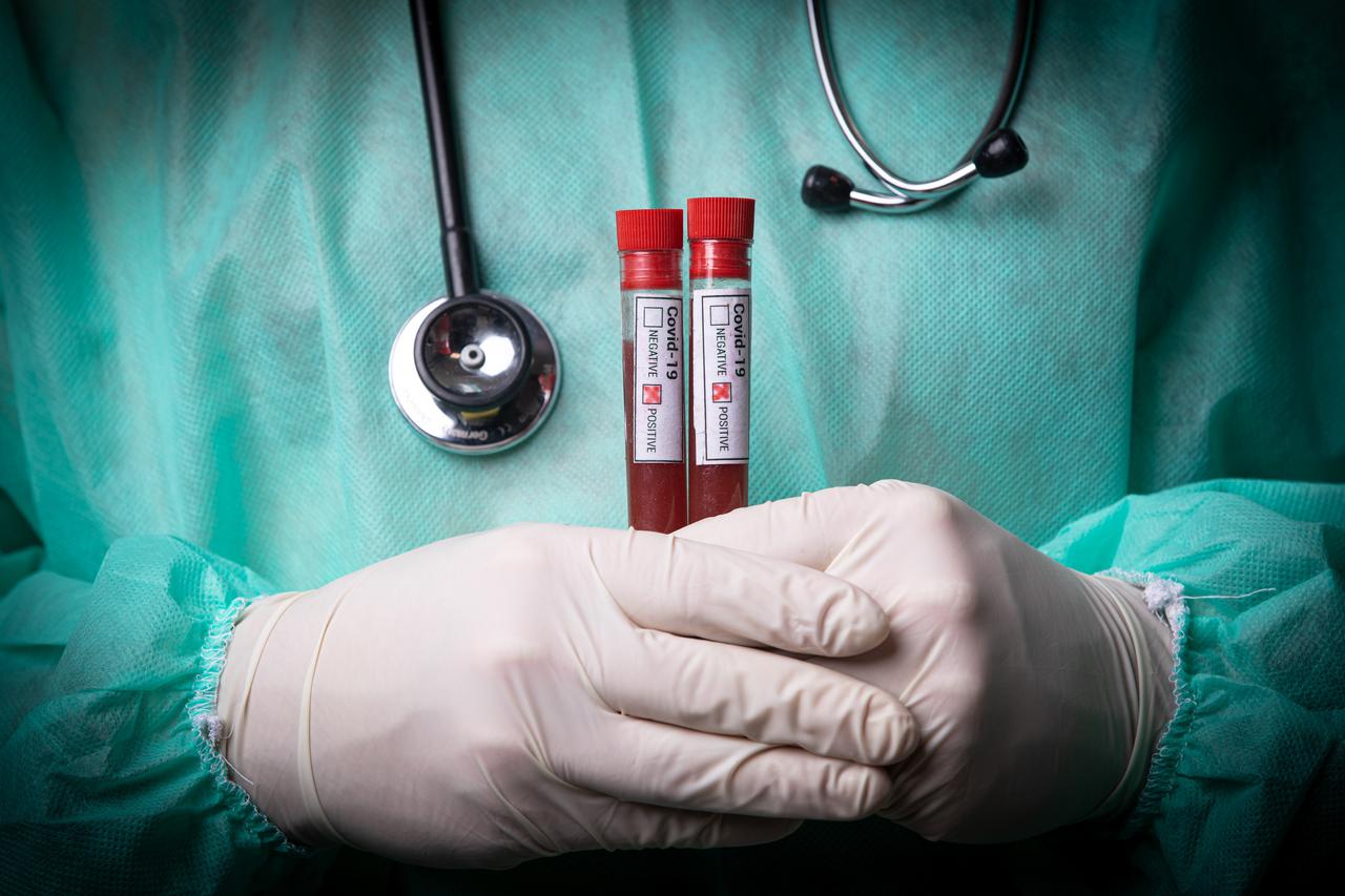Epruvete s uzorcima krvi - testiranje na koronavirus