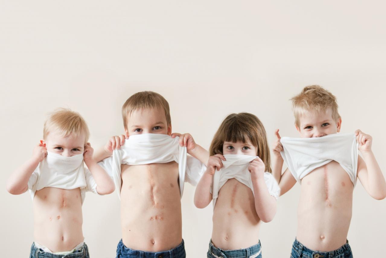 Veliko srce malom srcu1