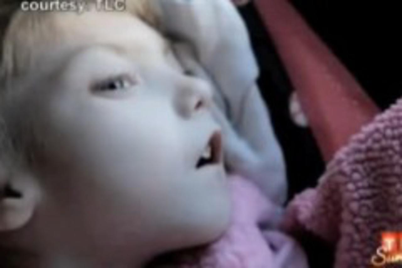 djevojcica,starenje,gabby