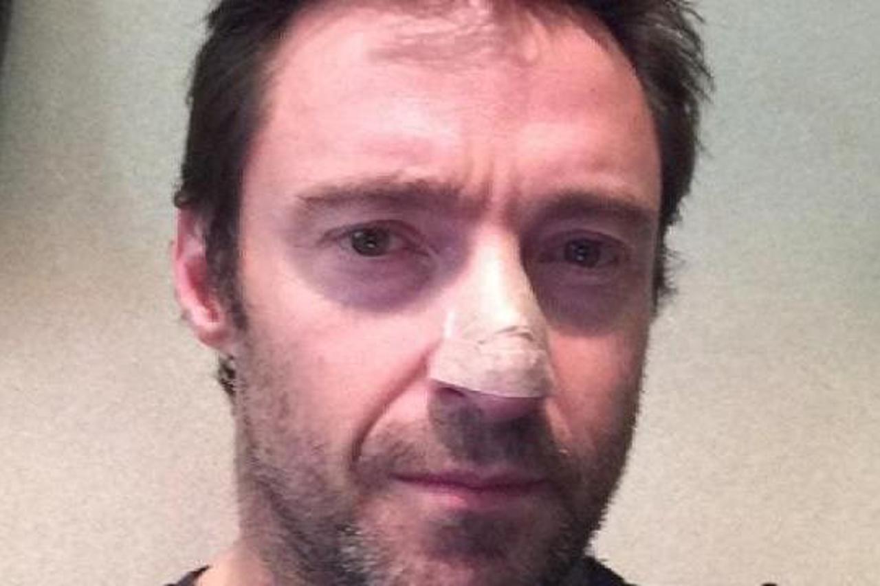 hugh jackman