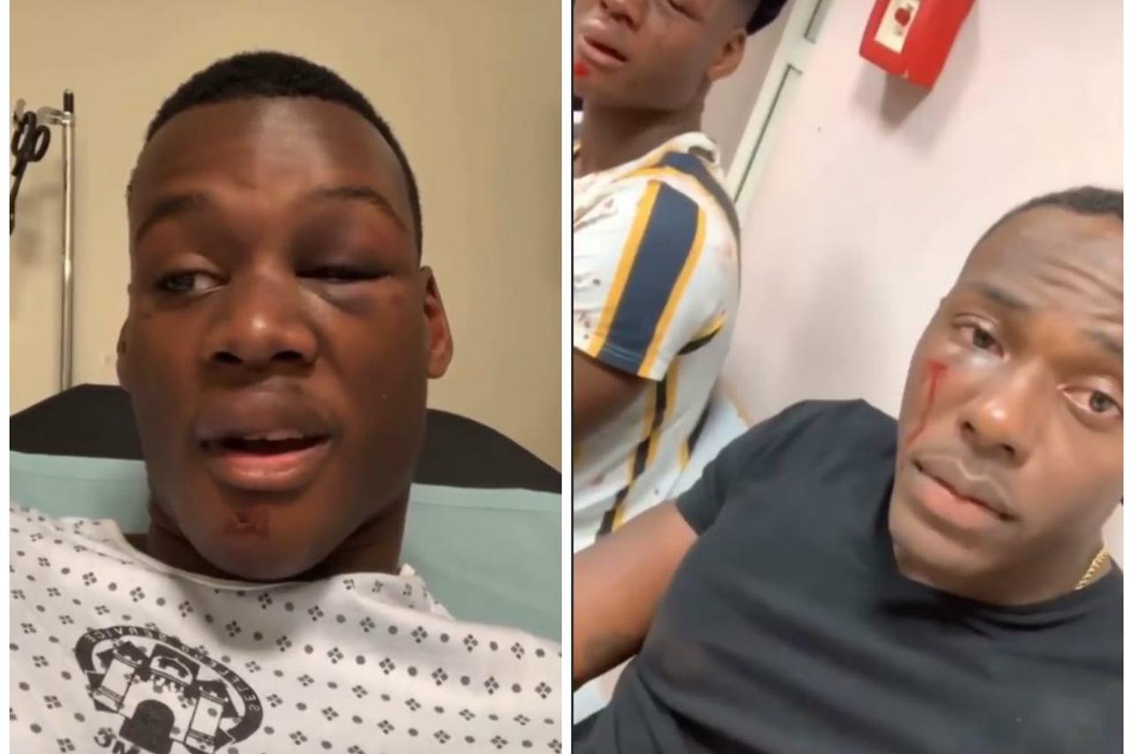 Napadnuti Amerikanci