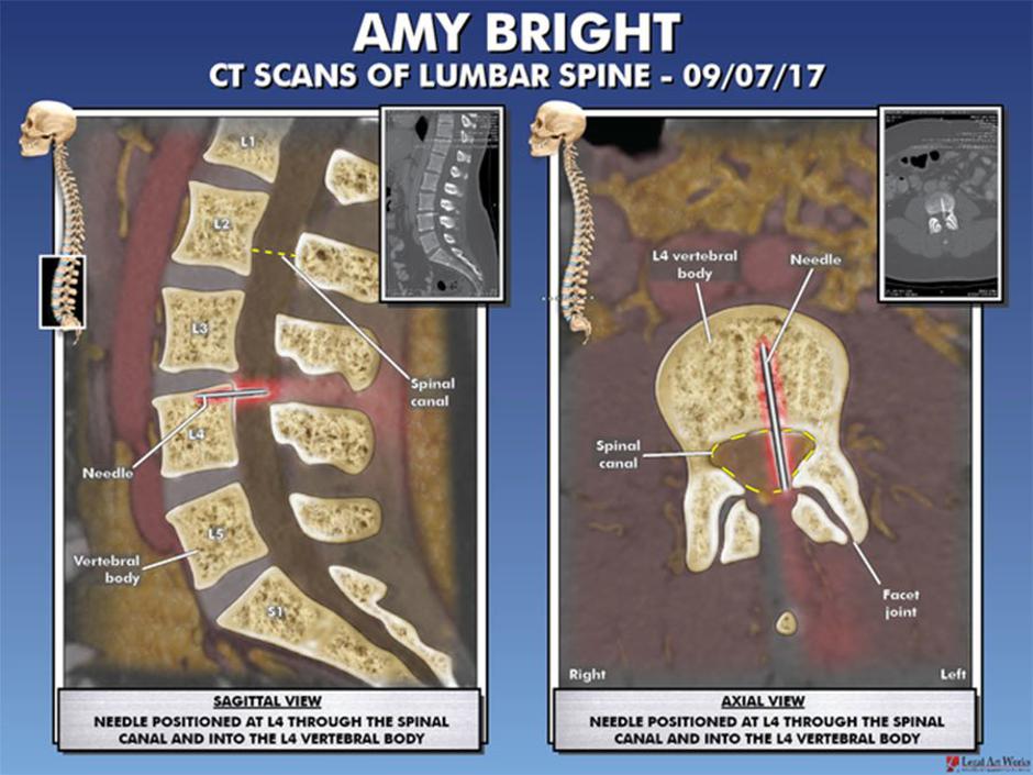 Amy Bright
